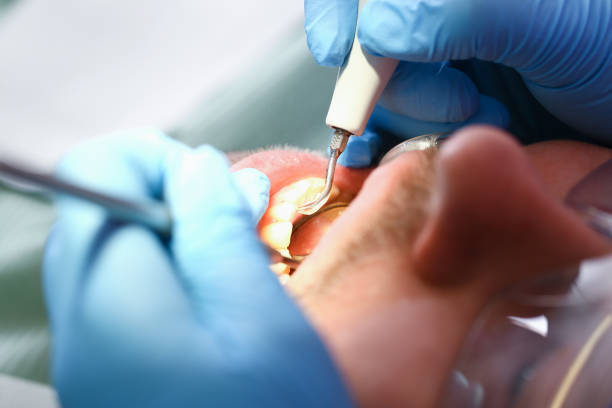 Best Emergency Dental Care for Sports Injuries in Knox, PA